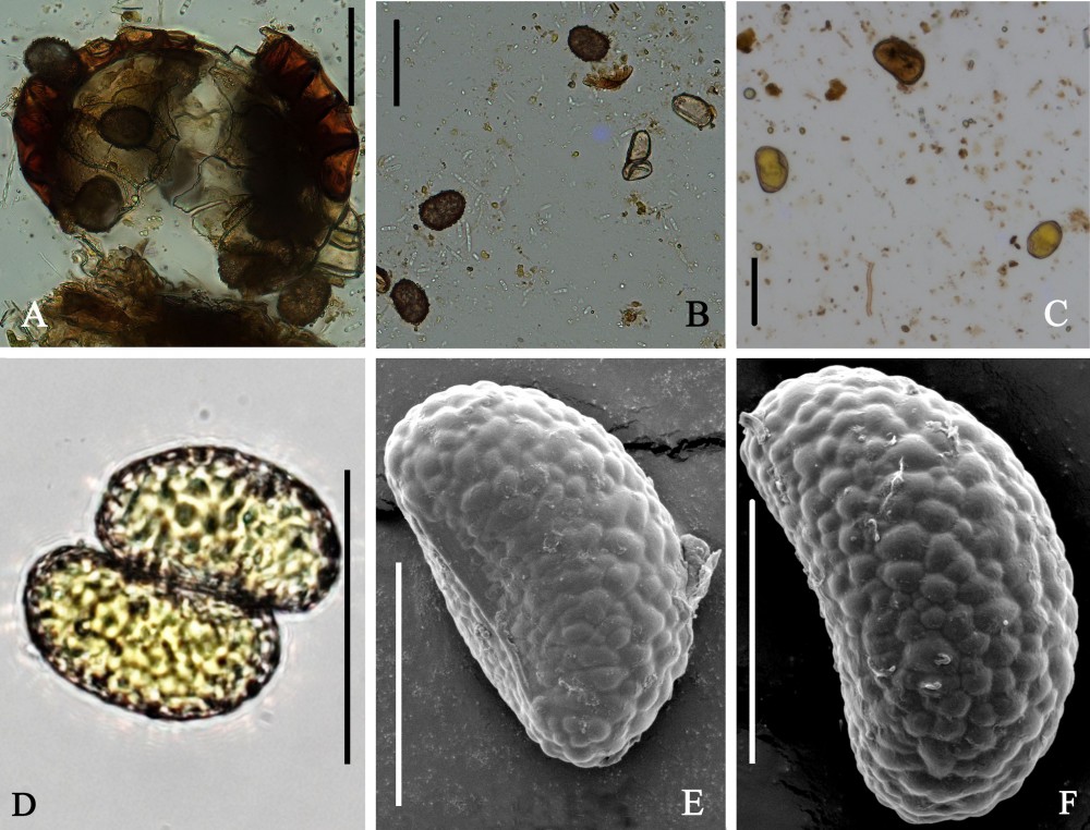 图2 友水龙骨孢子被取食前后的显微观察